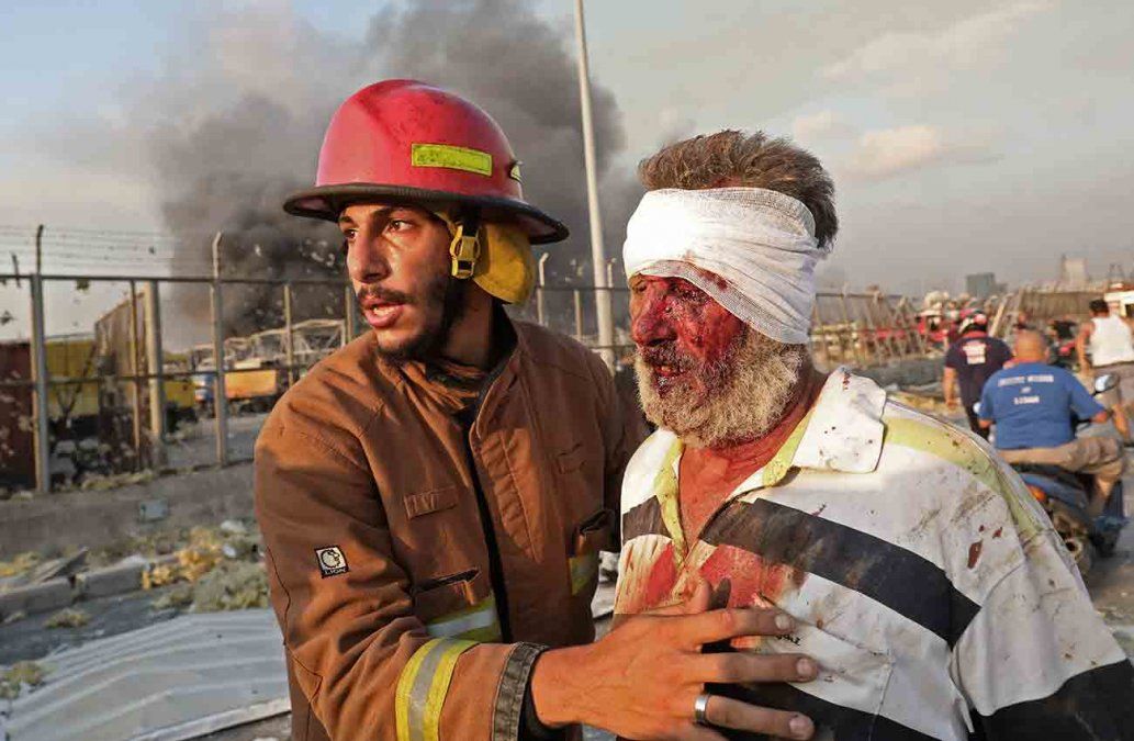 Un bombero socorre a un hombre severamente herido por las explosiones en Beirut