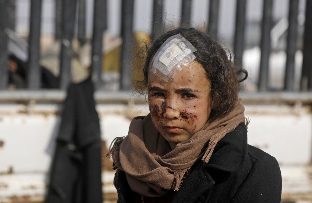 Una niña herida durante una operación de las Fuerzas Democráticas Sirias para expulsar al grupo Estado Islámico de la zona, en la provincia oriental de Siria.