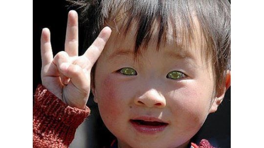 Niño chino tiene ojos que brillan y puede ver en la oscuridad