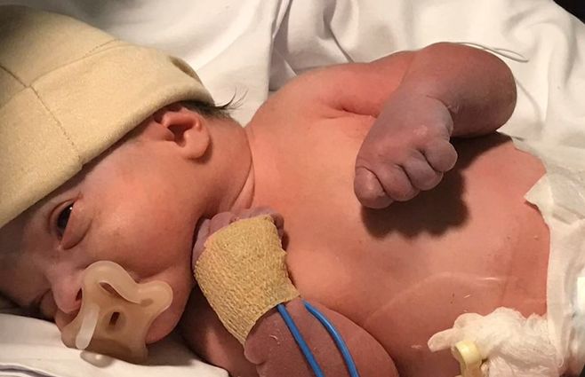 prematuro-bebé-nacimiento