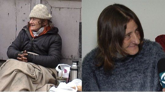pilar antes y despues