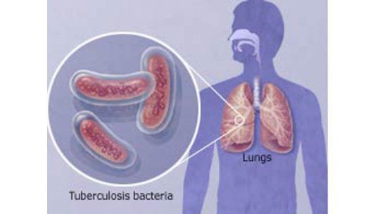 Alerta por foco de tuberculosis en una escuela de Punta de Rieles