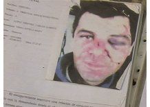 Hombre víctima de violencia doméstica pide protección