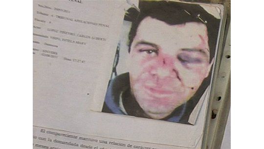 Hombre víctima de violencia doméstica pide protección