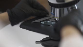 resistencia a antibioticos: senalan responsabilidad de las personas por prescripciones no adecuadas y automedicacion