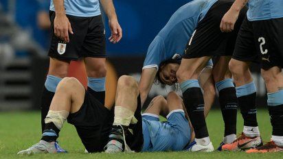 uruguay eliminado por penales tras errar suarez el primero ante peru