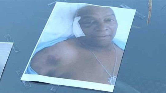 alberto rosa agredido taxi