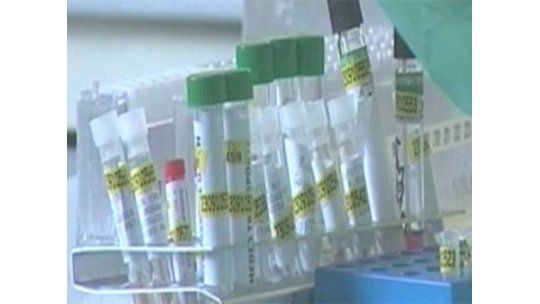 Uruguay con baja mortalidad por gripe H1N1 según MSP