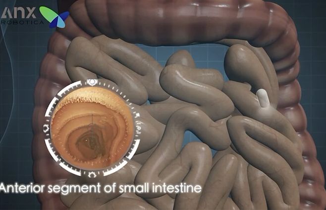 capsula-gastroenterologia
