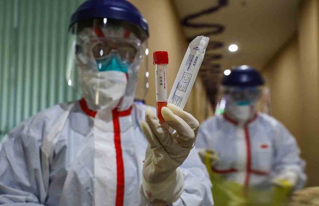 china-muestras-coronavirus-AFP.jpg