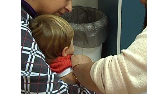 Preocupa al MSP aumento de casos de varicela