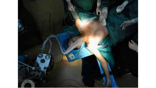 pechos de vacaciones