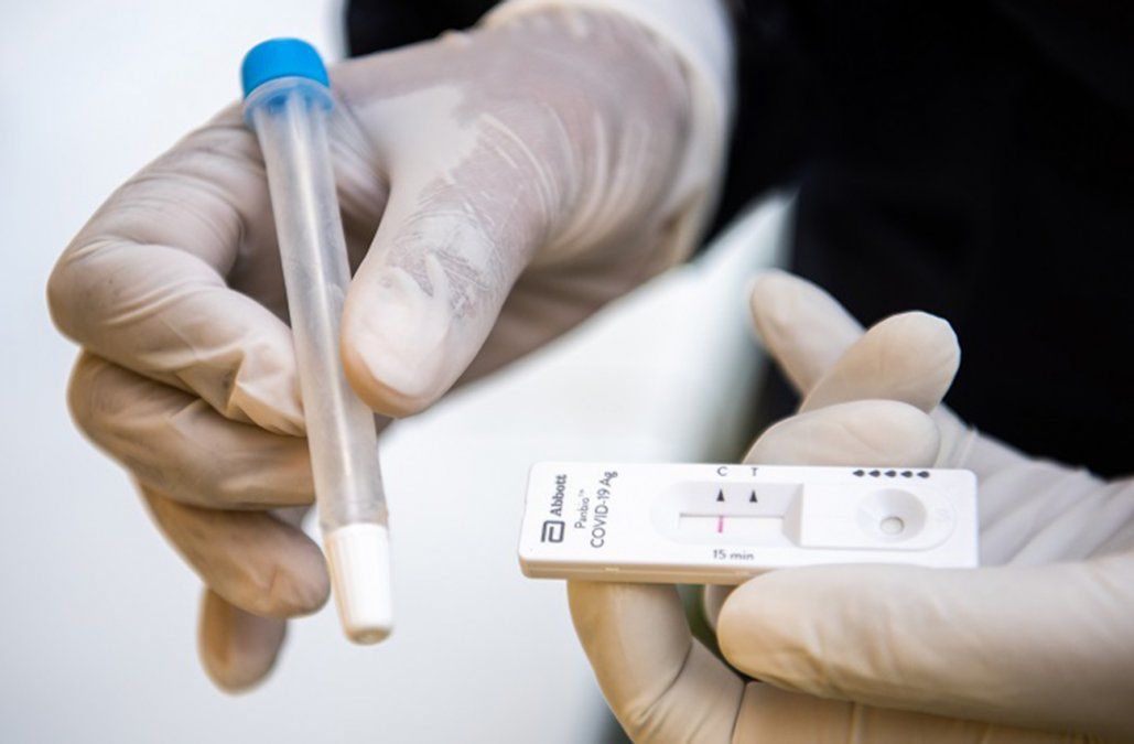 Estas son las 19 farmacias habilitadas para realizar test de antígenos
