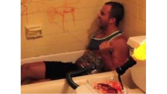 ¡Qué amigos!: le hicieron creer que le robaron un riñón