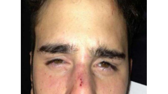 Golpean a una pareja gay: agresores invocan al papa Francisco