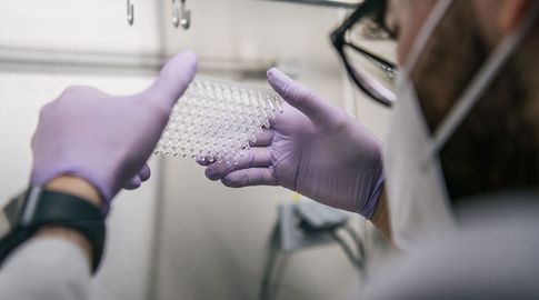 Se reportaron 1.417 casos nuevos de Covid, una cifra que no se daba desde fines de junio