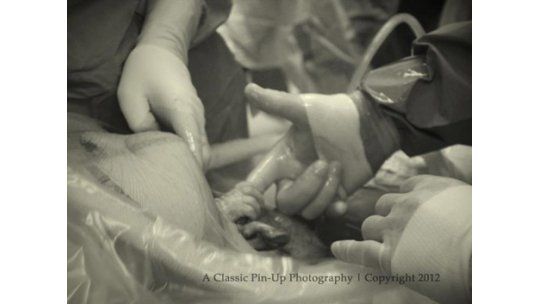 La foto de un nacimiento enternece y causa furor en Facebook