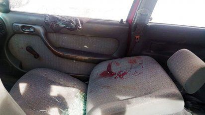 un policia termino en cti con graves heridas en el rostro