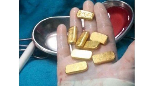 Contrabandista ambicioso: hallan barras de oro en su estómago