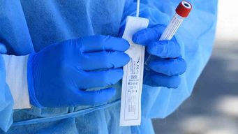 se registraron 85 casos nuevos de covid y hay 8 pacientes internados en cti