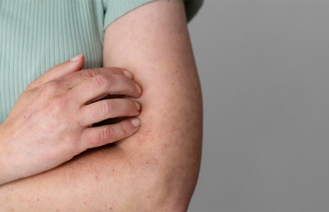 esquema de vacunación en uruguay