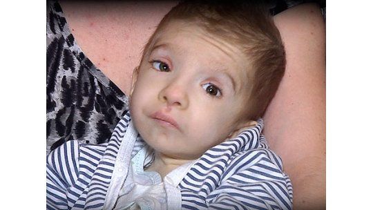 Niño con enfermedad rara necesita viajar a Cuba y pide ayuda