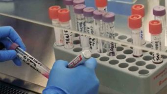 aumento la circulacion viral de covid, pero autoridades de la salud descartan una nueva ola