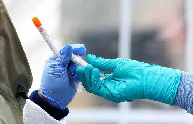 coronavirus-test-sangre-hoy.jpg