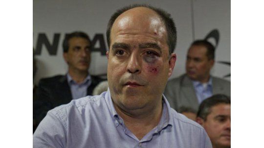 Brutal agresión a diputados opositores en Parlamento venezolano