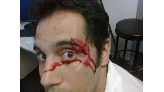Funcionario del Hospital Español denuncia golpes del director