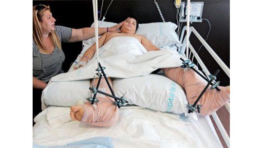 Reimplantan ambos pies a un niño de 10 años