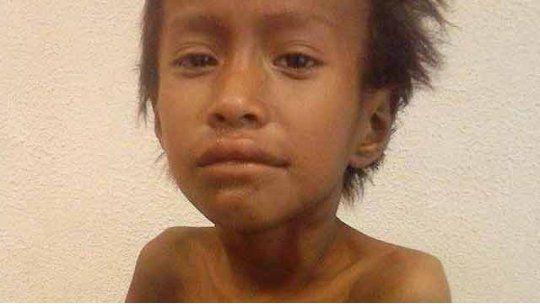 Néstor Femenía, niño quom, desnutrición