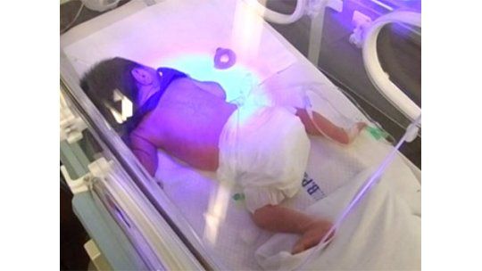 Subió la mortalidad infantil: 8,93 por cada mil nacidos en 2011