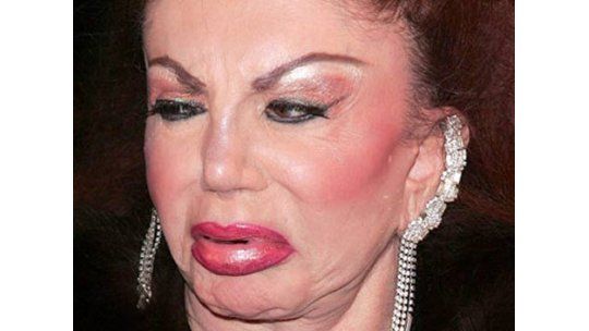 La madre de Stallone deformada por las cirugías estéticas