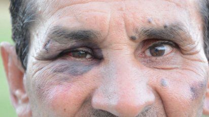 si llegaban a arrancar esos aviones no se que pasaba con nosotros