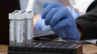 Se registraron 12 fallecidos por coronavirus y 634 casos nuevos