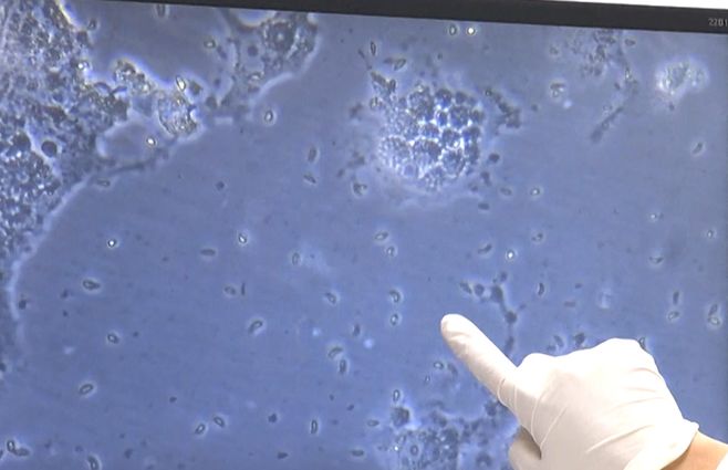 toxoplasmosis-laboratorio-pasteur