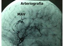 Niño con grave patología cerebral fue operado en Tacuarembó