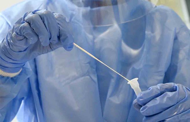 Bajo a 6.149 los cantidad activos de Coronavirus; hubo 396 casos nuevos