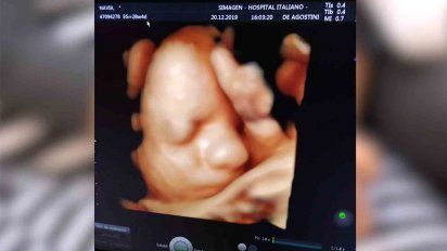 todos por valentin: un bebe necesita nacer en ee.uu para ser operado de una cardiopatia