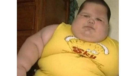 Misterio médico en Brasil: niño de 3 años pesa 70 kilos