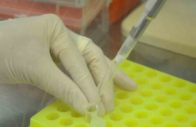 Coronavirus en Uruguay: 709 nuevos casos, 11 fallecidos y 98 en CTI