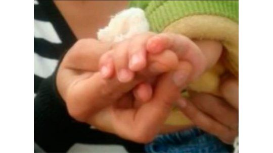 Por error, enfermera de Melo amputó la punta de un dedo a un bebé