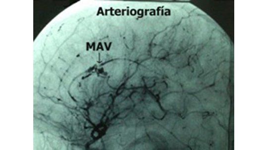 Niño con grave patología cerebral fue operado en Tacuarembó