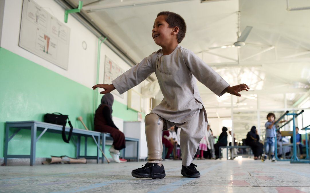 La alegría de un niño amputado que baila con su prótesis nueva conmueve al mundo