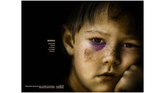 Tres niños con desnutrición y golpes; padres fueron procesados