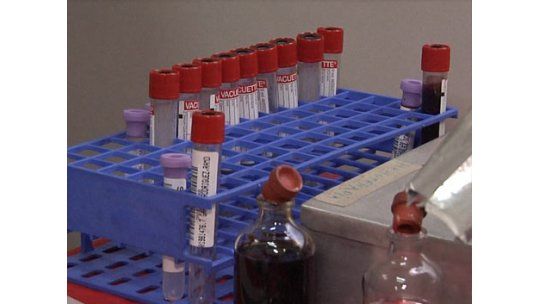 Médico que dejó en CTI a deportista ofreció tratar a Mujica