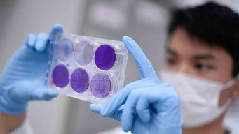 uruguay: se registraron 1.020 casos nuevos, hay 72 pacientes en cti