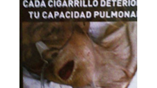 La foto de una víctima del tabaquismo genera juicio y polémica