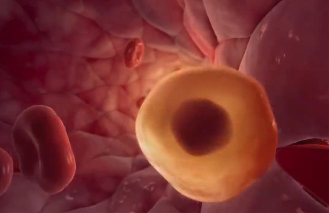 cancer-animacion-archivo.jpg